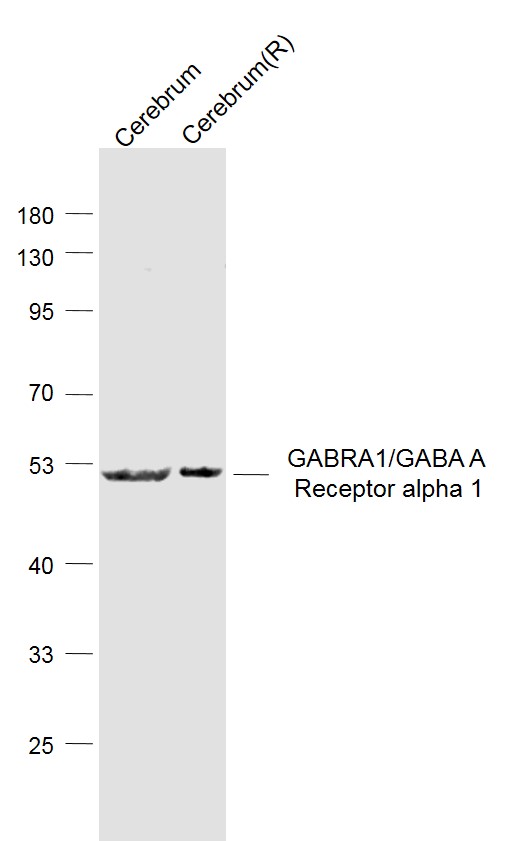 GABRA1/GABA A Receptor alpha 1