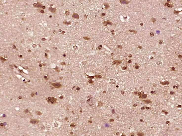 BCL2L15 Rabbit pAb(bs-7582R)-5