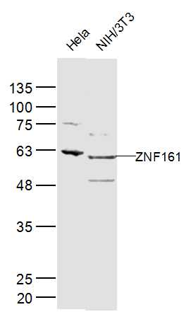 ZNF161 Rabbit pAb(bs-12791R)-5
