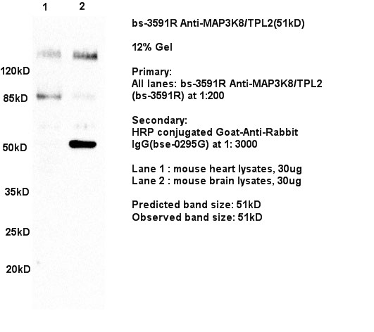 MAP3K8 Rabbit pAb(bs-3591R)-50