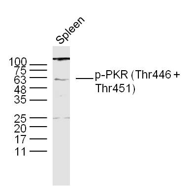 phospho-PKR (Thr446 + Thr451)