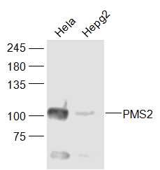 PMS2 Rabbit pAb(bs-10398R)-50u