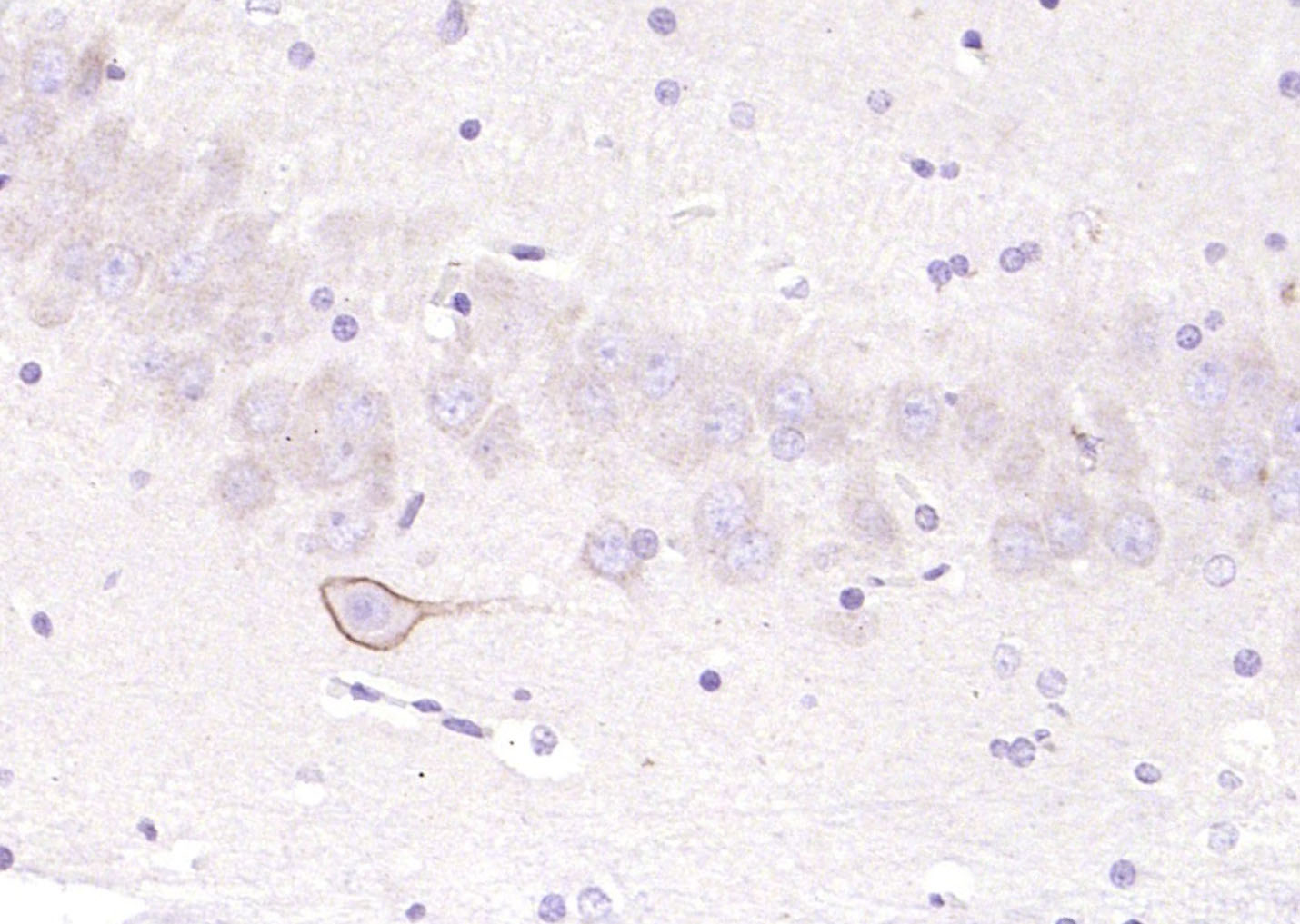 phospho-PLCG1 (Tyr771) Rabbit