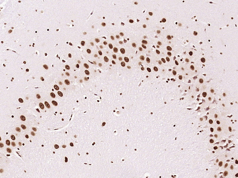 KLHL7 Rabbit pAb(bs-5935R)-50u