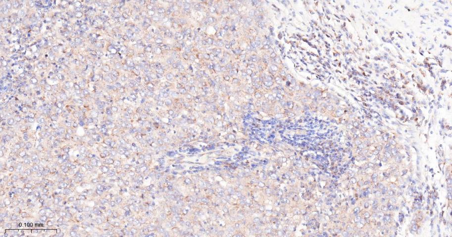 mTOR Recombinant Rabbit mAb(bs