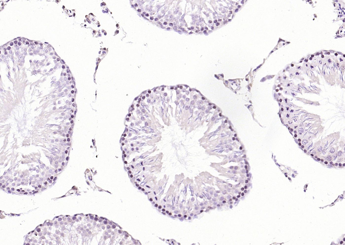 PLK1 Rabbit pAb(bs-3535R)-50ul