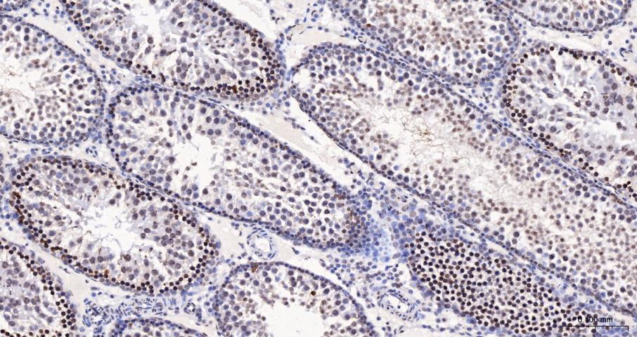 Histone H3(di methyl K27) Mous