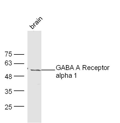 GABRA1/GABA A Receptor alpha 1