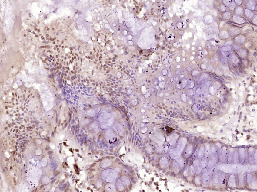 MSH6 Rabbit pAb(bs-3804R)-50ul