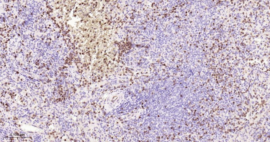 TYMS Recombinant Rabbit mAb(bs