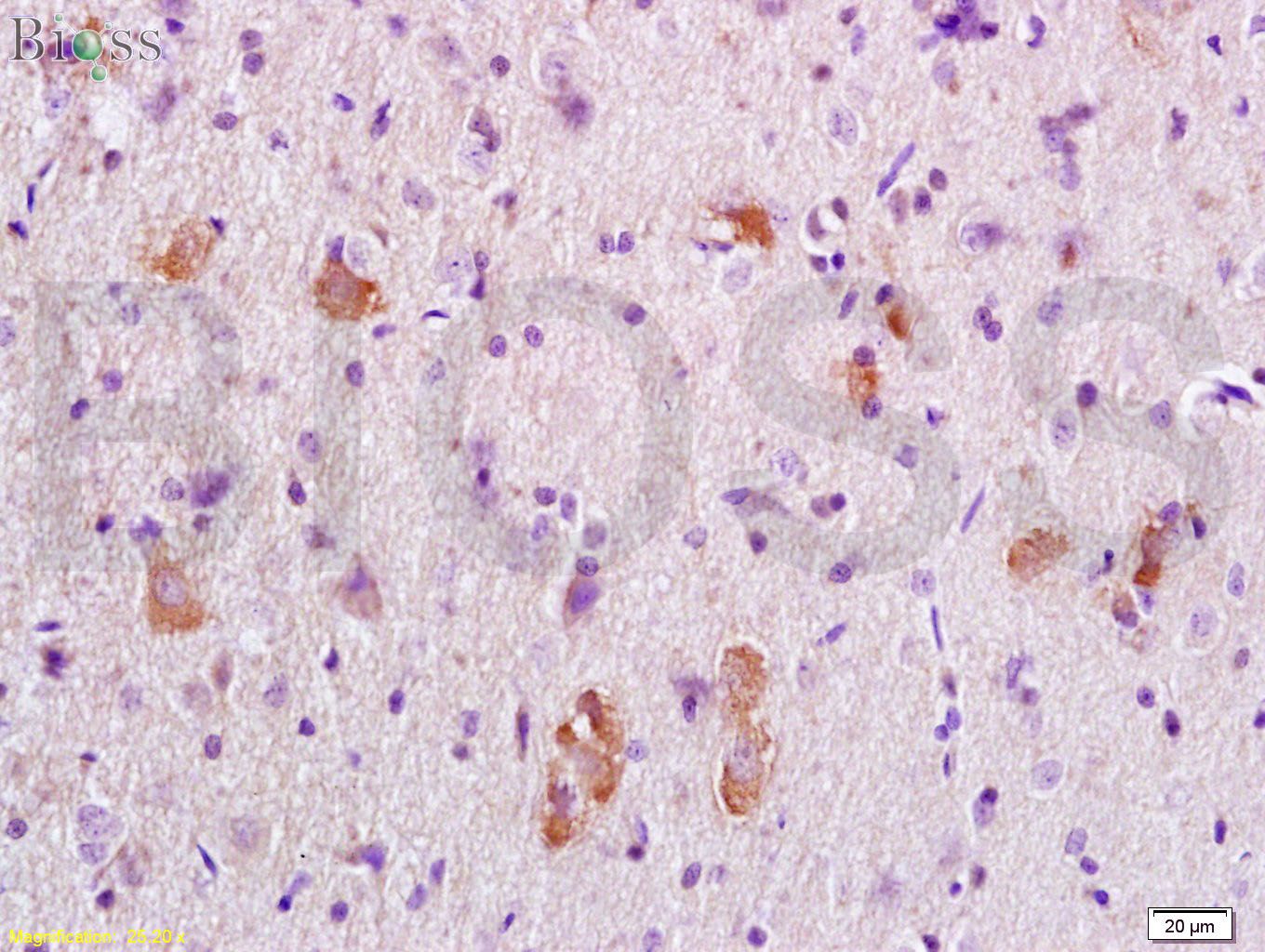 APC Rabbit pAb(bs-3680R)-50ul/