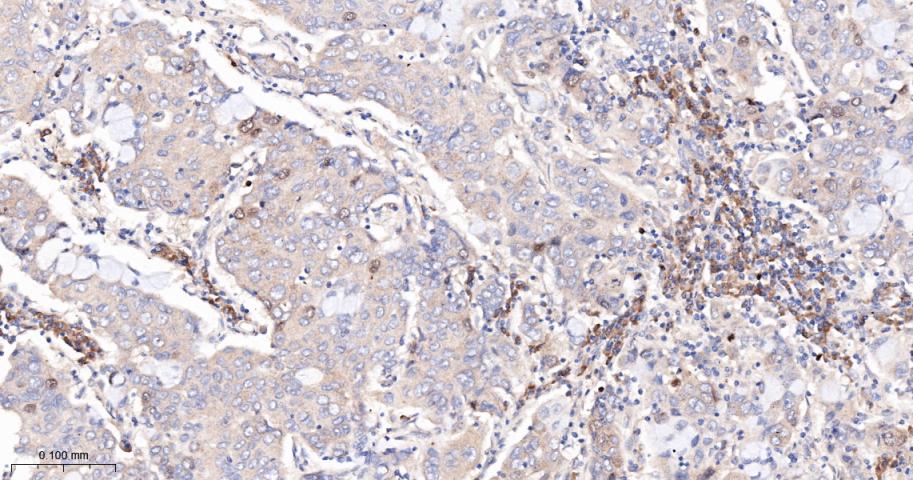 CCNA2 Recombinant Rabbit mAb(b