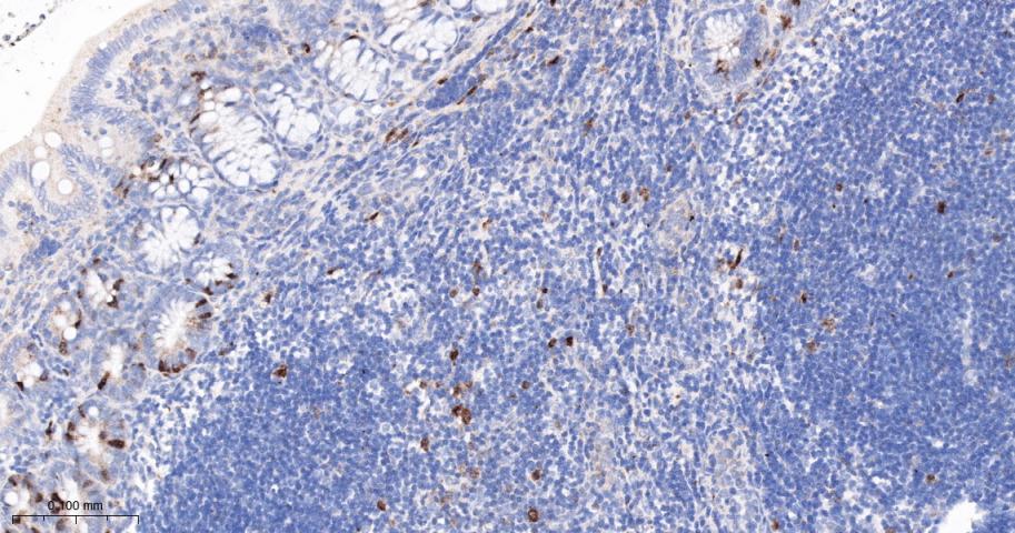CCNA2 Recombinant Rabbit mAb(b