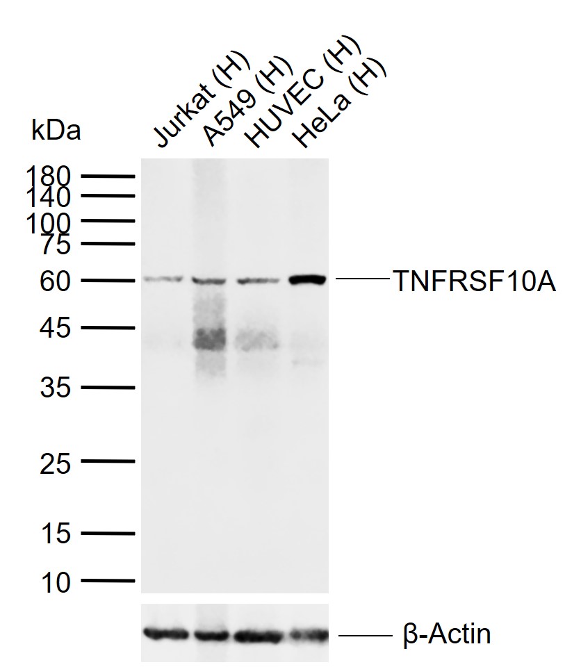 TNFRSF10A Rabbit pAb(bs-0591R)
