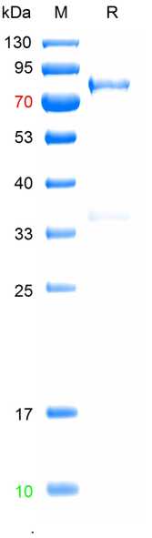 Recombinded ASFV p72 protein(b