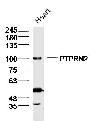 PTPRN2 Rabbit pAb(bs-20830R)-5