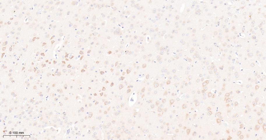 mTOR Recombinant Rabbit mAb(bs