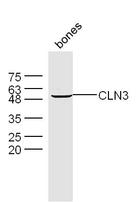 CLN3 Rabbit pAb(bs-8016R)-50ul
