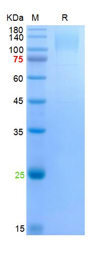 Recombinant SARS-Cov-2 Spike S