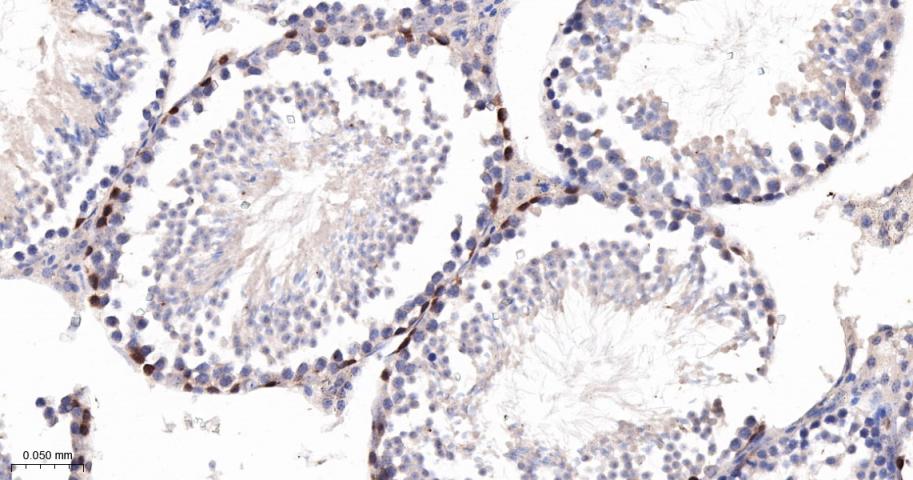 CCNA2 Recombinant Rabbit mAb(b