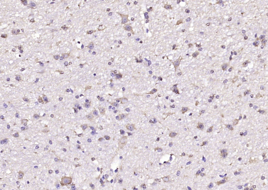Arginyl tRNA synthetase Rabbit