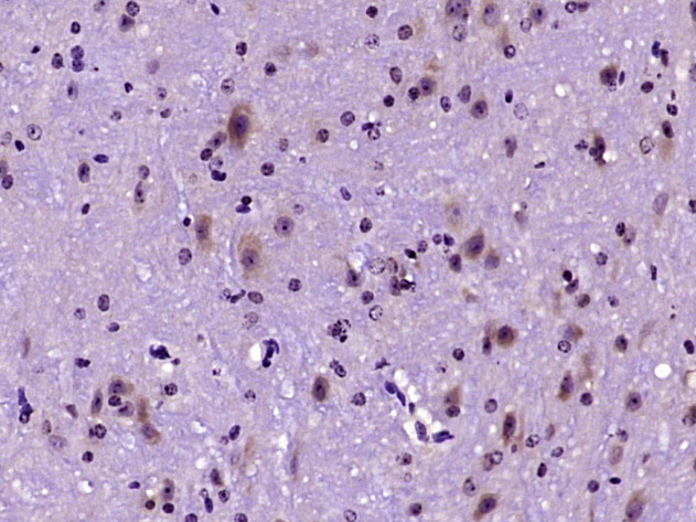 Phospholipase C beta 2 Rabbit 