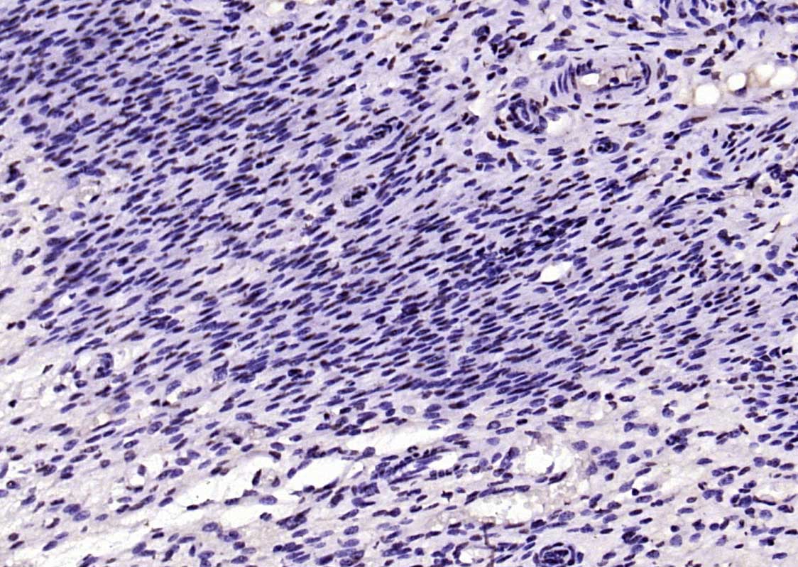 SIK1 Rabbit pAb(bs-6252R)-50ul