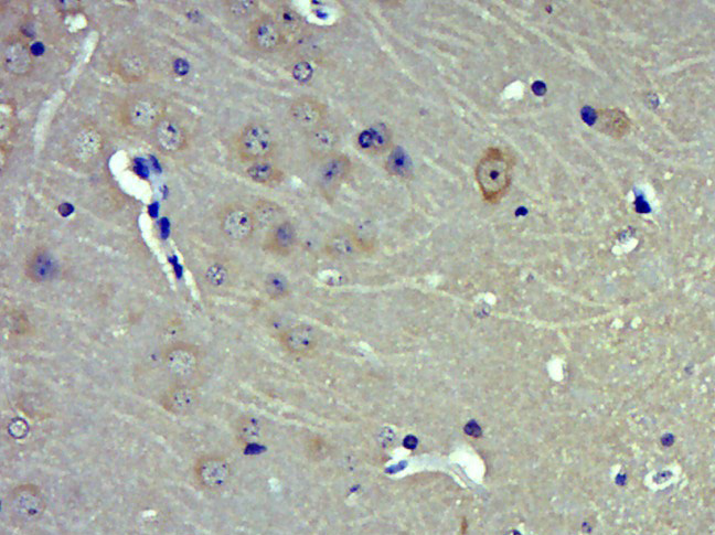 MAN2B1 Rabbit pAb(bs-18647R)-5