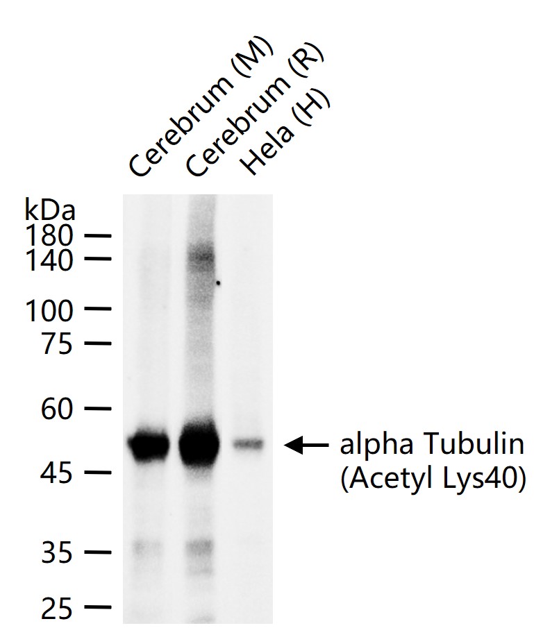 alpha Tubulin (Acetyl Lys40) M