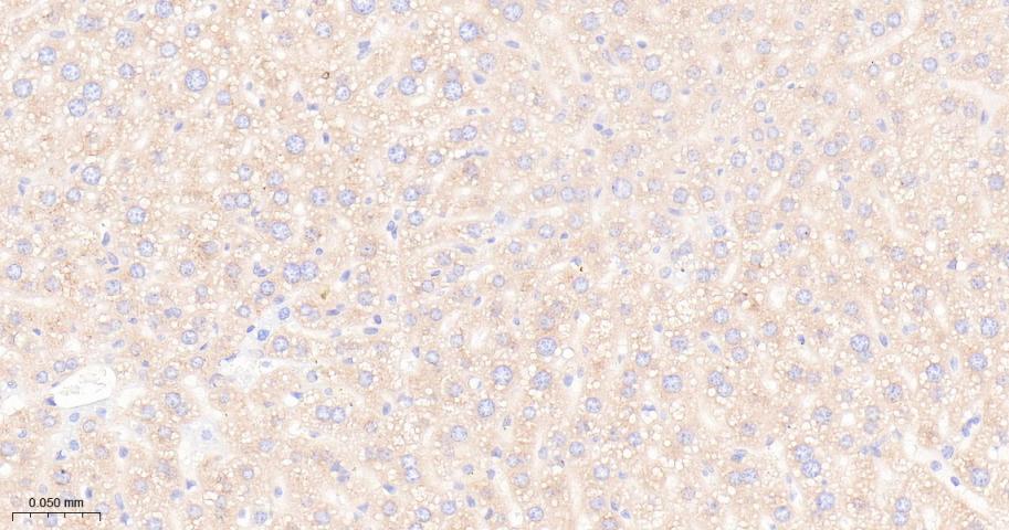 mTOR Recombinant Rabbit mAb(bs