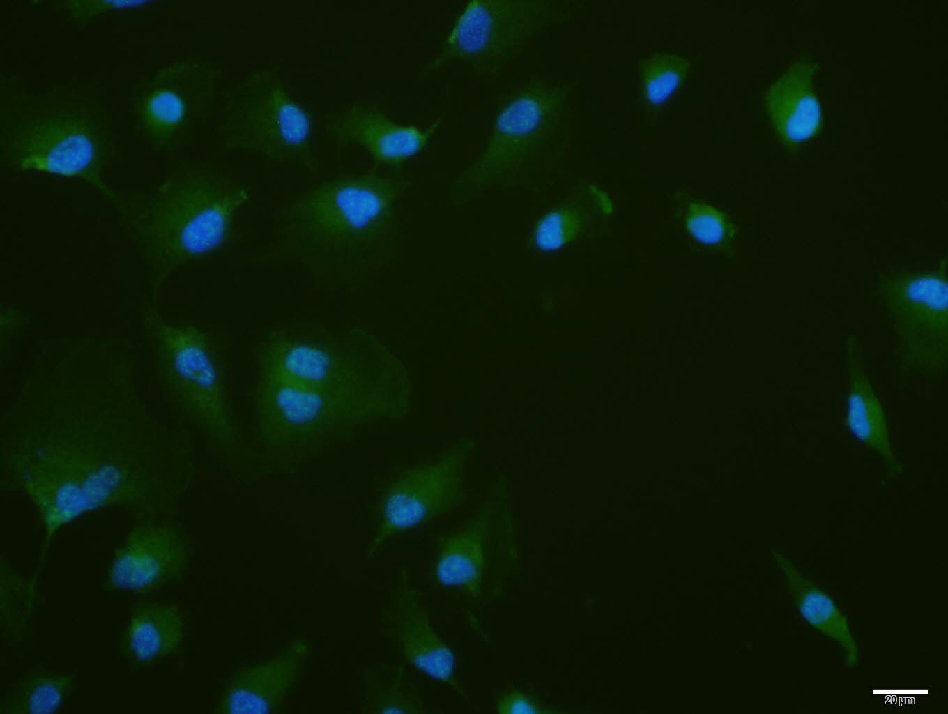 phospho-PKR (Thr446 + Thr451)