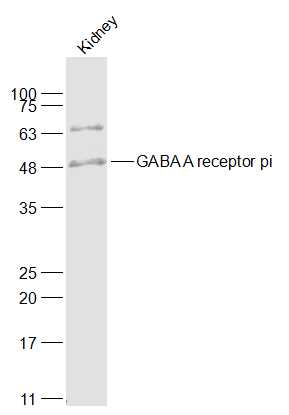 GABA A receptor pi Rabbit pAb(
