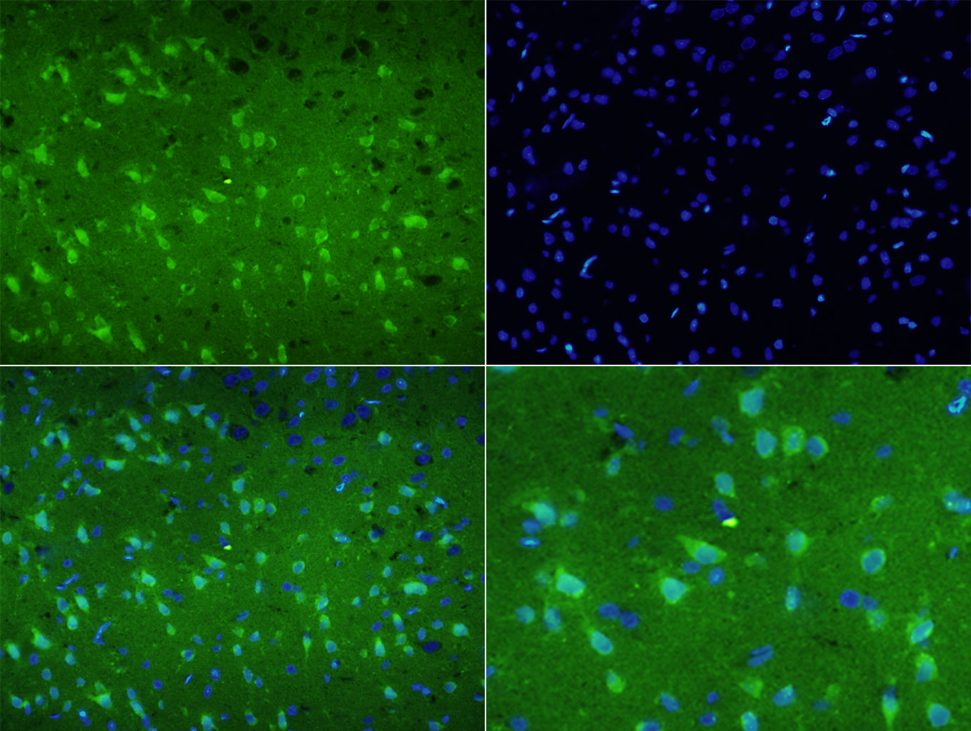 DYNC1I1 Rabbit pAb(bs-10470R)-