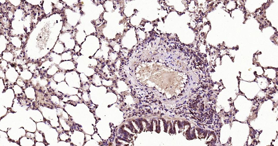 RAB5B Rabbit pAb(bs-11783R)-50