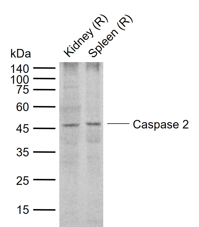 Caspase 2 Rabbit pAb(bs-5802R)