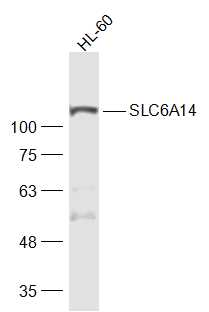 SLC6A14 Rabbit pAb(bs-21023R)-