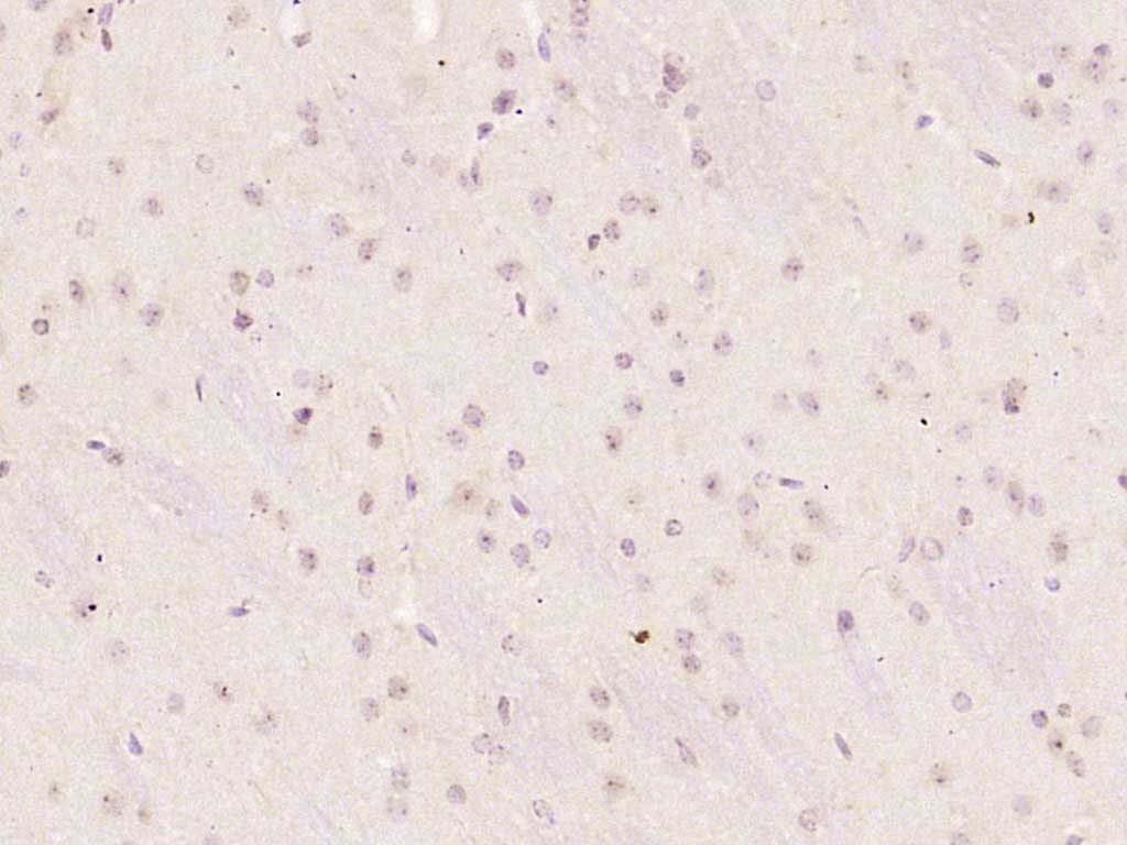 E2F3 Rabbit pAb(bs-21439R)-50u