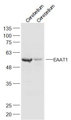 EAAT1 Rabbit pAb(bs-23309R)-50