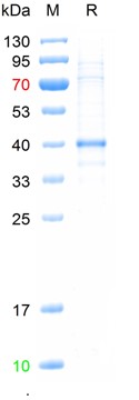 Recombinant human ANO1 protein