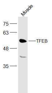 TFEB Rabbit pAb(bs-5137R)-50ul