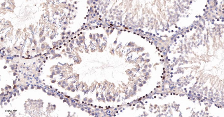 CCNA2 Recombinant Rabbit mAb(b