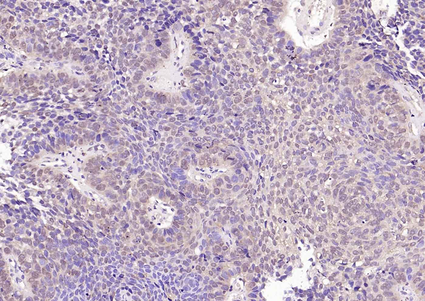 VEGFR3 Rabbit pAb(bs-2202R)-50