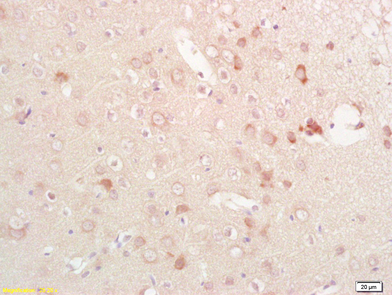 phospho-Eph receptor B1 (Tyr92