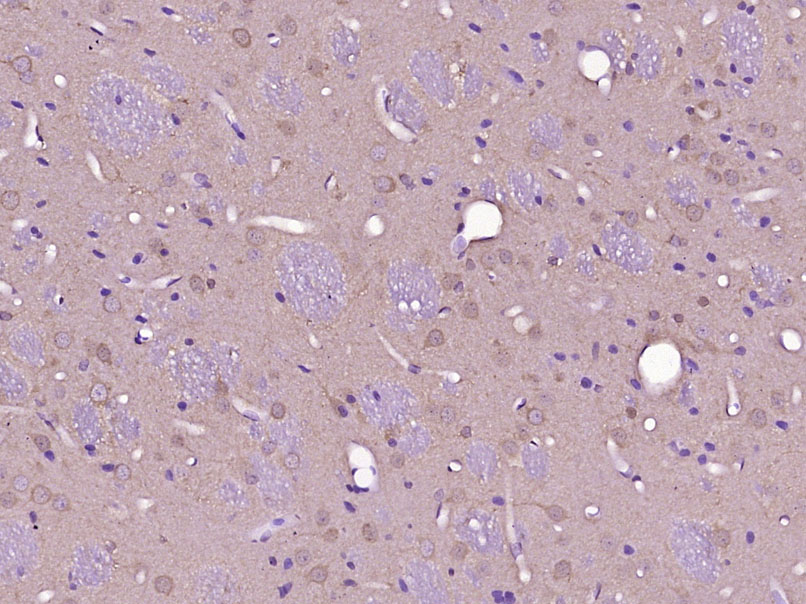 TMEM132D Rabbit pAb(bs-19953R)