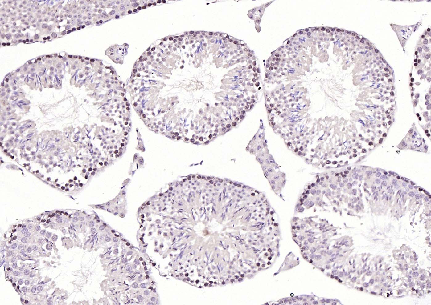 CREM Rabbit pAb(bs-5135R)-50ul