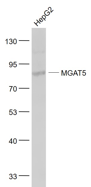 MGAT5 Rabbit pAb(bs-5841R)-50u