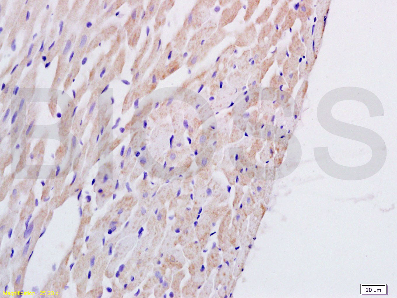 PAFR/PAF Receptor Rabbit pAb(b