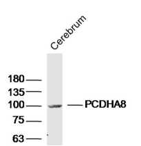 PCDHA8 Rabbit pAb(bs-11122R)-5
