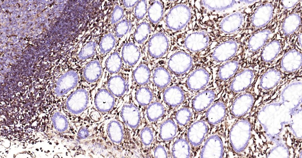 Vimentin Mouse mAb(bsm-33170M)