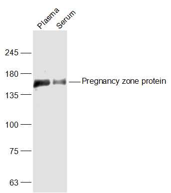 Pregnancy zone protein Rabbit 